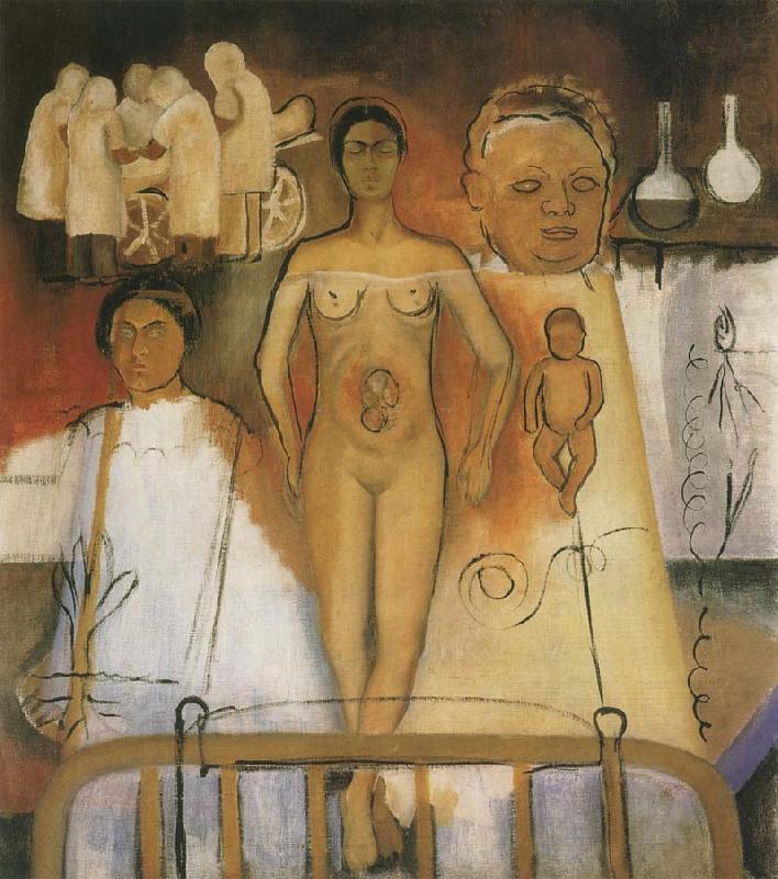 Image result for frida and the cesarean operation